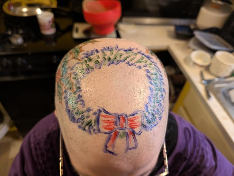 I have been  losing my hair for medical reasons. Need help shaving my skull once a week.